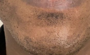 Clinica Dental Rebeca Marco