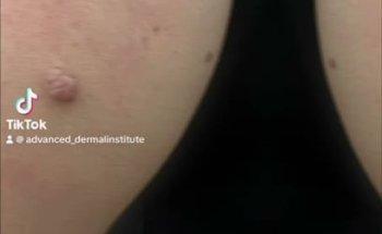 Advanced Dermal Institute