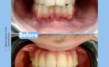 Buckingham Gate Orthodontics