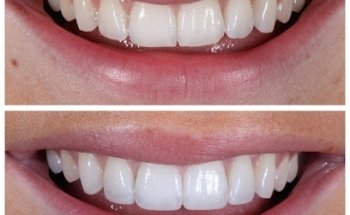 Ringway Dental - Cosmetic and Implant Dentistry- Manchester