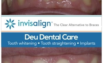 Deu Dental Care Headingley