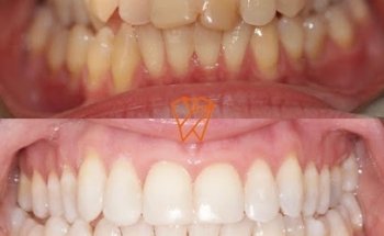 Clayhall Dental Care - Cosmetic & Implant Dentistry