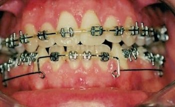 Clinica Dental San Pedro