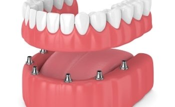 Benfleet Dental Centre