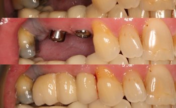 Arnold Dental & Implant Centre