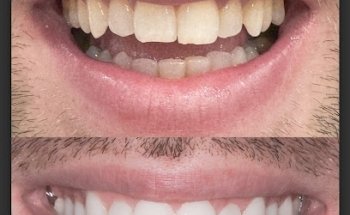 Butterfly Dental Care