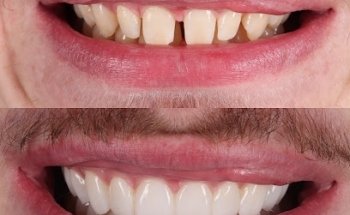 Monument Dental Studio