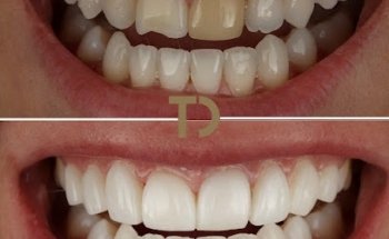 Transform Dental (formerly known as Knutsford Road Dental Clinic)