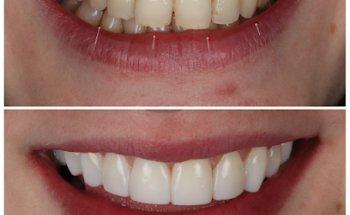 Bamber Bridge Dental Care