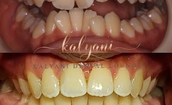 Kalyani Dental Lounge and Gallery