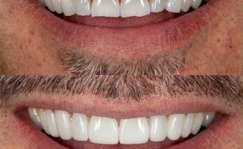 Smile Rooms Milton Keynes