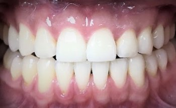 West Kensington NHS Dental Care