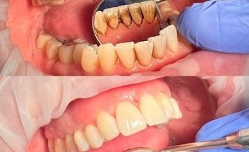 Pure Smiles Dental Hygiene Clinic, Fulham