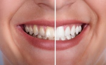 DentEuropa Implant & Orthodontic & Perio CENTRE