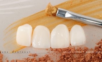 Clínica Dental Montagut