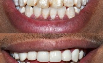 CLINICA DENTAL LA FUENSANTA BENIAJÁN