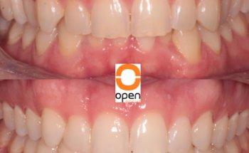 Open Dental Care