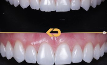 KissDental Alderley Edge