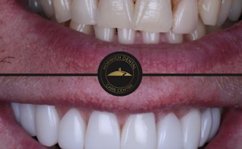 Horwich Dental Care Centre