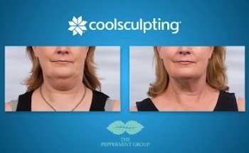 The Peppermint Group - Dental Clinic