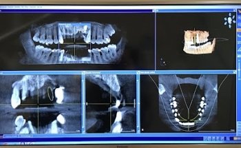 EspaiDental - Aleixandre Sanchis. Clínica Dental Picanya