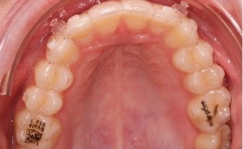 Ortodoncia Dr.León Valencia