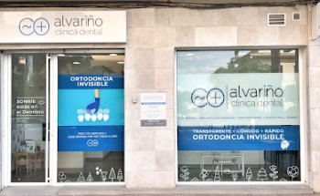 Alvariño Clínica Dental Picanya
