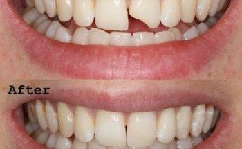 Fresh Dental Smile Clinic