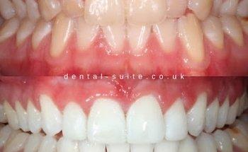 The Dental Suite - Loughborough