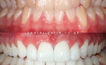 The Dental Suite - Leicester