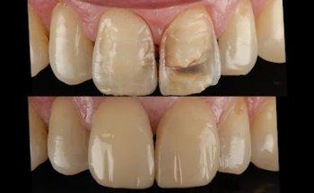 Kendal Dental Aesthetics and Implant Clinic