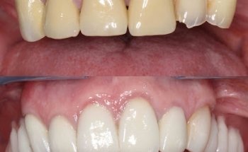 Thackeray Dental Care