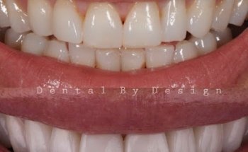 Dental By Design
