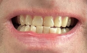 Clínica Dental Implantdent Palafrugell