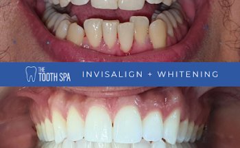 The Tooth Spa - Emergency Dentist, Private Dentist, Leeds Leeds