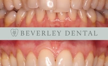 Beverley Dental