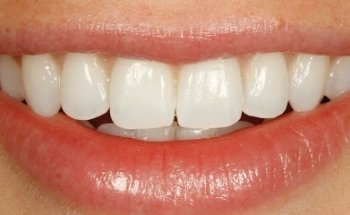 Dr Tom Lotka - Invisalign Sheffield