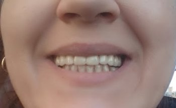 Clínica Dental Más Que Sonrisas | Fuenlabrada