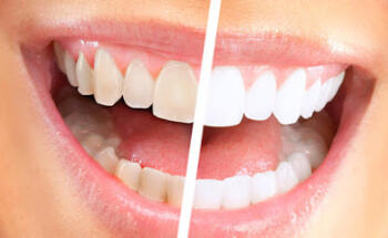 Acer Dental Practice