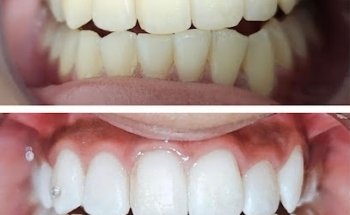 Covent Garden Aesthetic Clinic