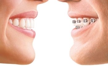 Teethinline Orthodontics