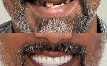 Celebration Family Dental of Carrollton