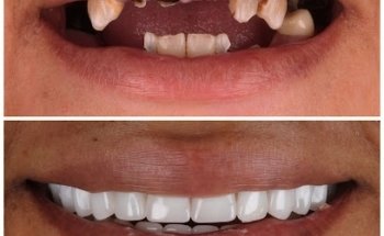 Austin Artistic Dental