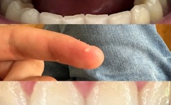 Clínica Dental Adeslas