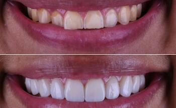 Carlsbad Beach Dental - Drew Addy, DDS