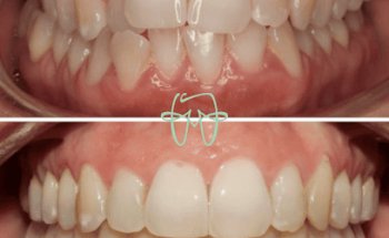 Clínica Dental Dra. Isabel Almoril