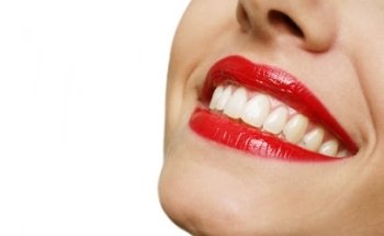 Clínica Dental Broseta Valencia
