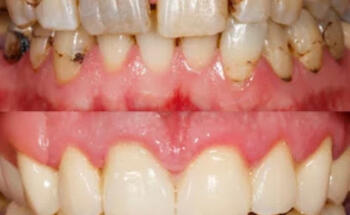 Advanced Dental Care Lakewood