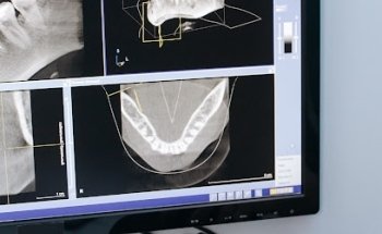 Kualitas Dental Irun