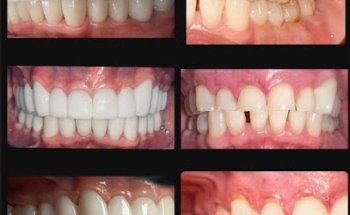 Dentist Catoosa - Dental Arts of Catoosa